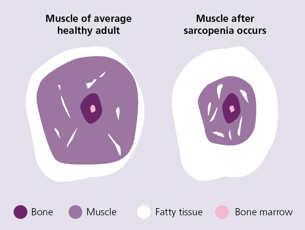 BDA Muscle Health Nutrition muscle graphic