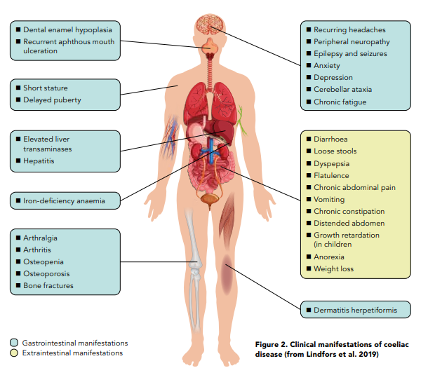 Figure 2. Clinical manifestations of coeliac disease (from Lindfors et al. 2019)