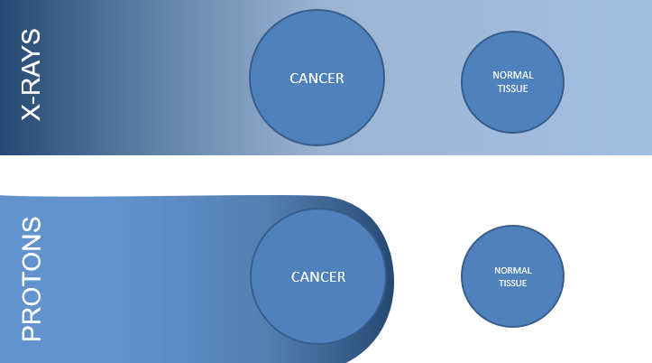 Proton beam therapy figure 1.png